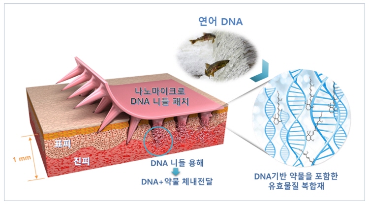 기사제목